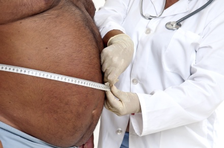 What Experts Says About Obesity